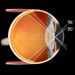 Super 66® Lens VOLK