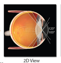 VOLK QUADR PEDIATRIC ( VQPED ) Retinopatia wcześniaków ROP