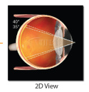 Fundus Laser Lens VOLK