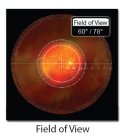 VOLK SUPER MACULA 2.2 ( VSMAC2.2 )