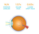 VOLK jednorazowa Capsulotomy VCAPSD10 box 10 szt