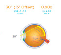 Direct Image 15 Prism SSV® (ACS®) Lens VOLK