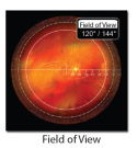 VOLK Quadr Aspheric z kryzą ( VQFL )