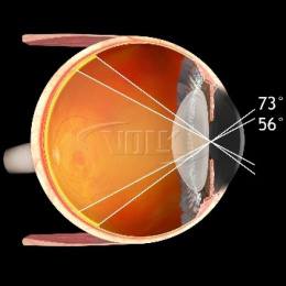 VOLK Pan Retinal 2.2 ( VPRC-LE ) Szampańskie Złoto limitowana