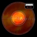 VOLK Pan Retinal 2.2 Multi Kolor VPRC-LE2