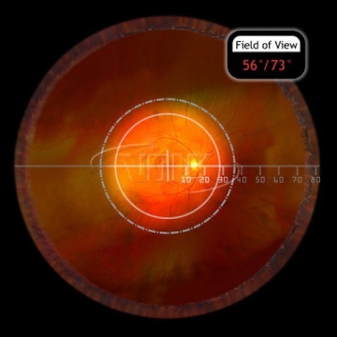 VOLK Pan Retinal 2.2 Multi Kolor VPRC-LE2 VOLK Pan Retinal 2.2 Multi Kolor VPRC-LE2