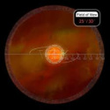 VOLK FUNDUS 20 mm z kryzą ( VFUNDUS20 ) laser