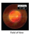 VOLK Central Retinal ACS® autoklaw VCRLVITACS